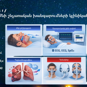 «Քնի շնչառական խանգարումների կլինիկական կառավարում»