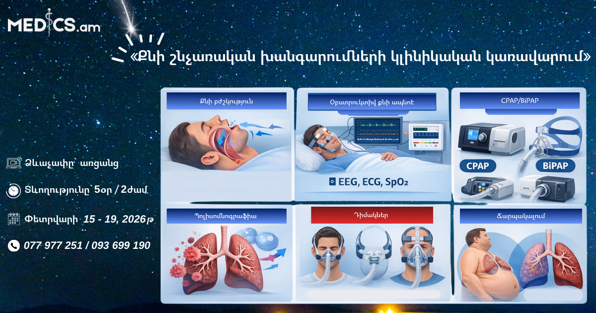 «Քնի շնչառական խանգարումների կլինիկական կառավարում»