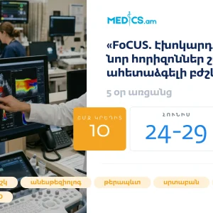Focus էխոկարդիոգրաֆիա